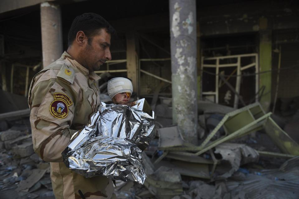  This tiny boy was found by Iraqi Army soldiers eating raw meat in the rubble. They said they first killed an ISIS soldier nearby then rescued him