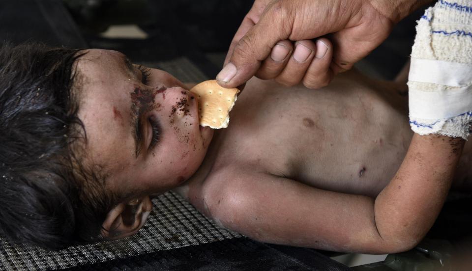  One starving toddler is given a biscuit after receiving medical help in an Iraqi emergency medical centre