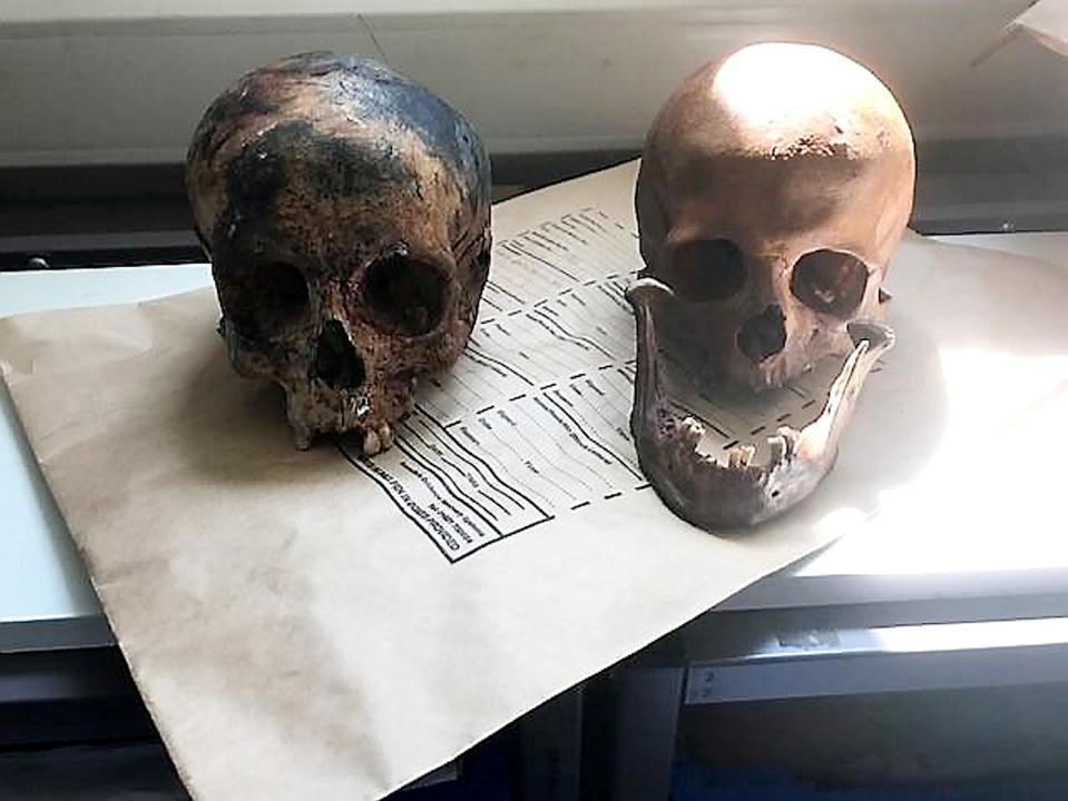  There was a male and female skull found