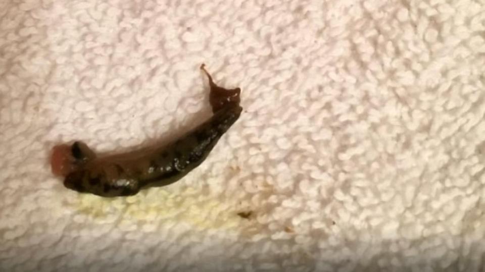  One person staying at the hotel found a dead slug wrapped in their towel