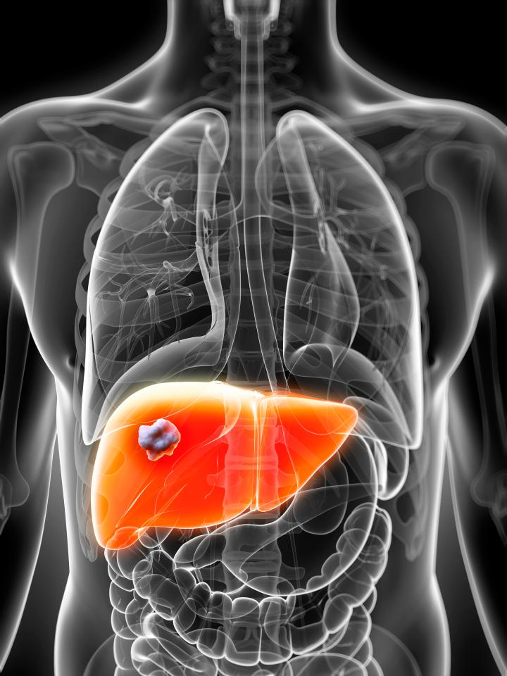  The spice can protect the liver from cirrhosis