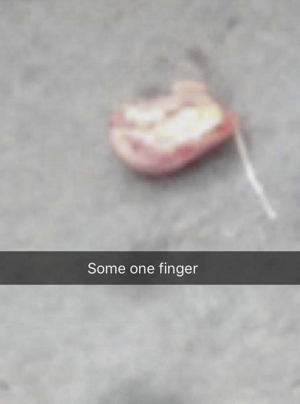  A picture posted online after the brawl with the caption 'Some one finger'