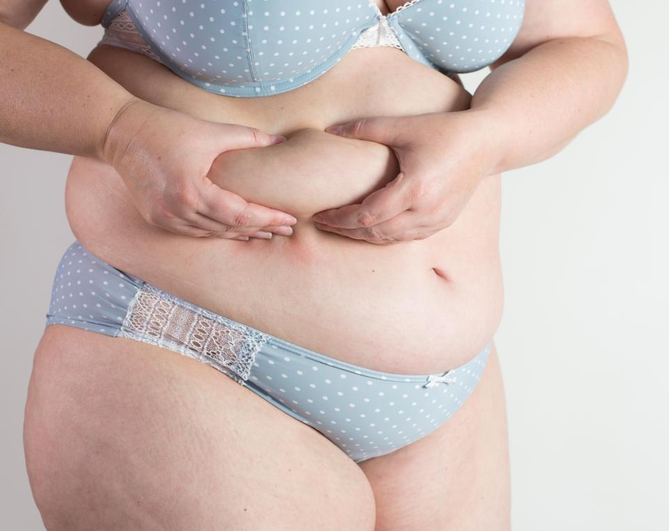  Obesity raises the risk of early death too, but by 20 per cent less than loneliness