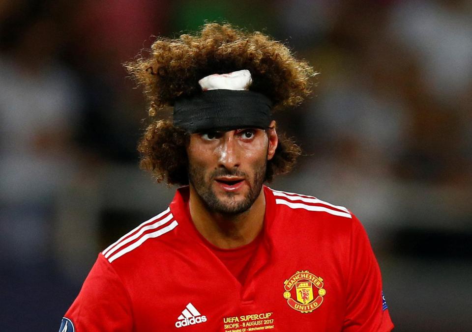  Marouane Fellaini was forced to wear a head band after his collision