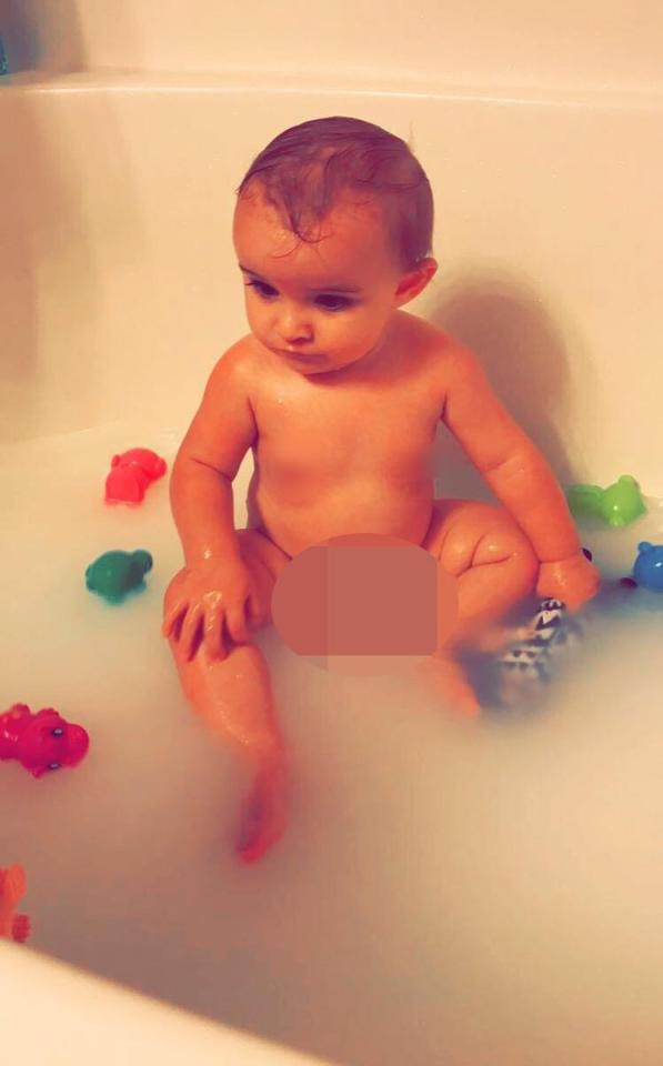  Daughter Ellianna is bathed in breast milk and warm water to sooth her skin