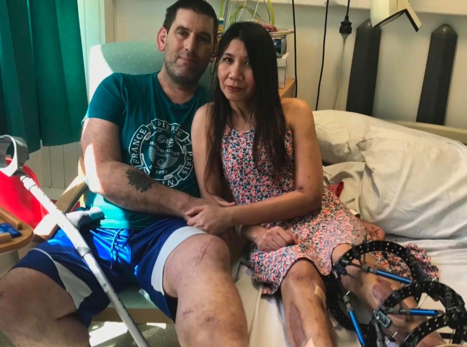  Robby Potter and his wife Leonora Ogerio spent three months in hospital after they were both severely injured in the blast