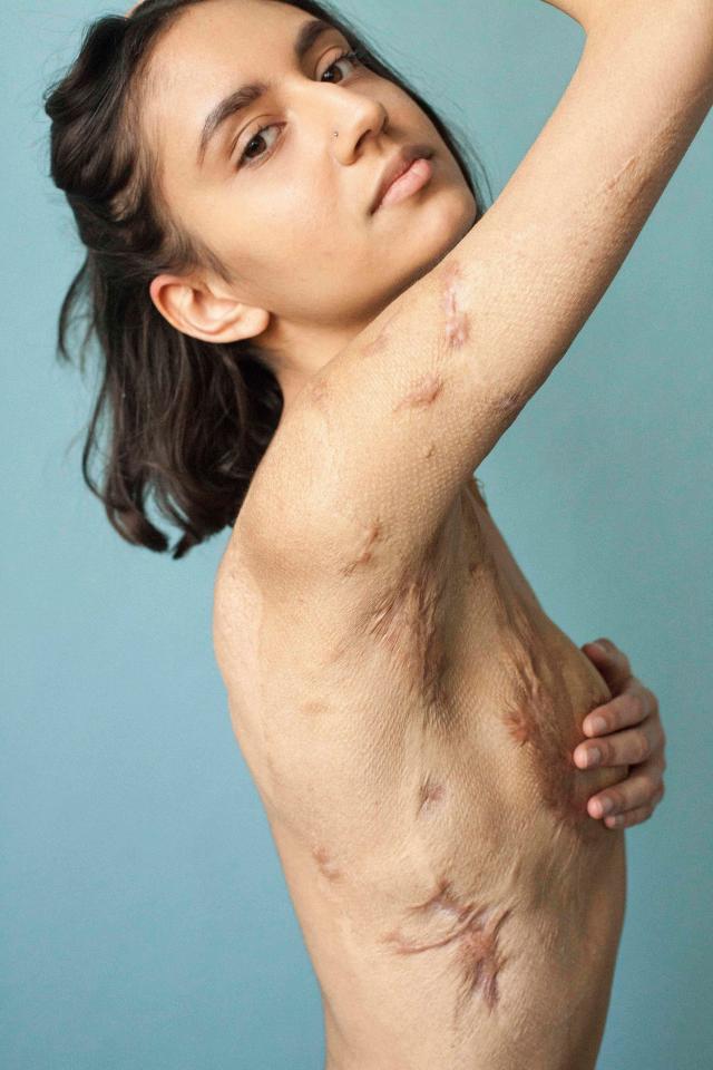  Photographer Sophie Mayanne has captured these stunning images as part of her Behind The Scars project