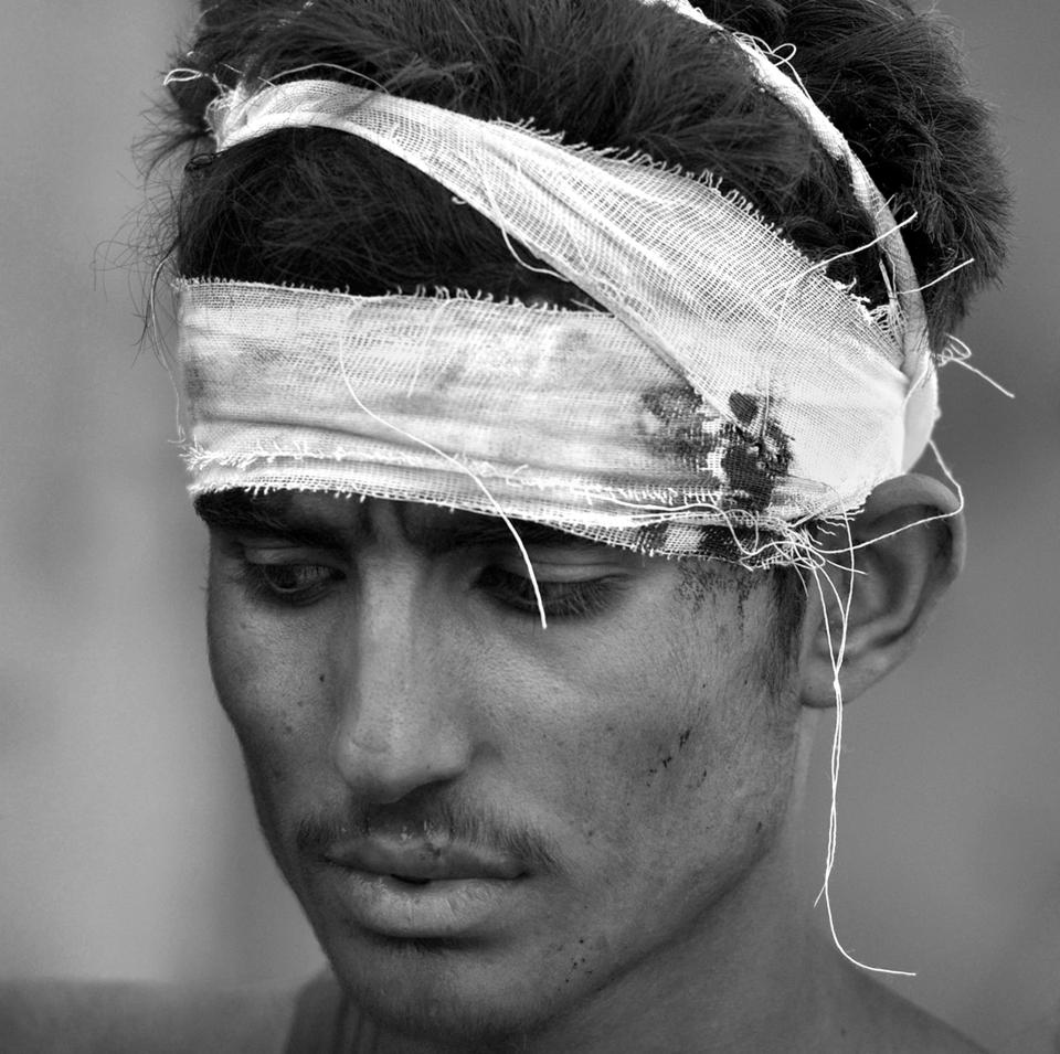  A young man with a head injury is treated in Mosul