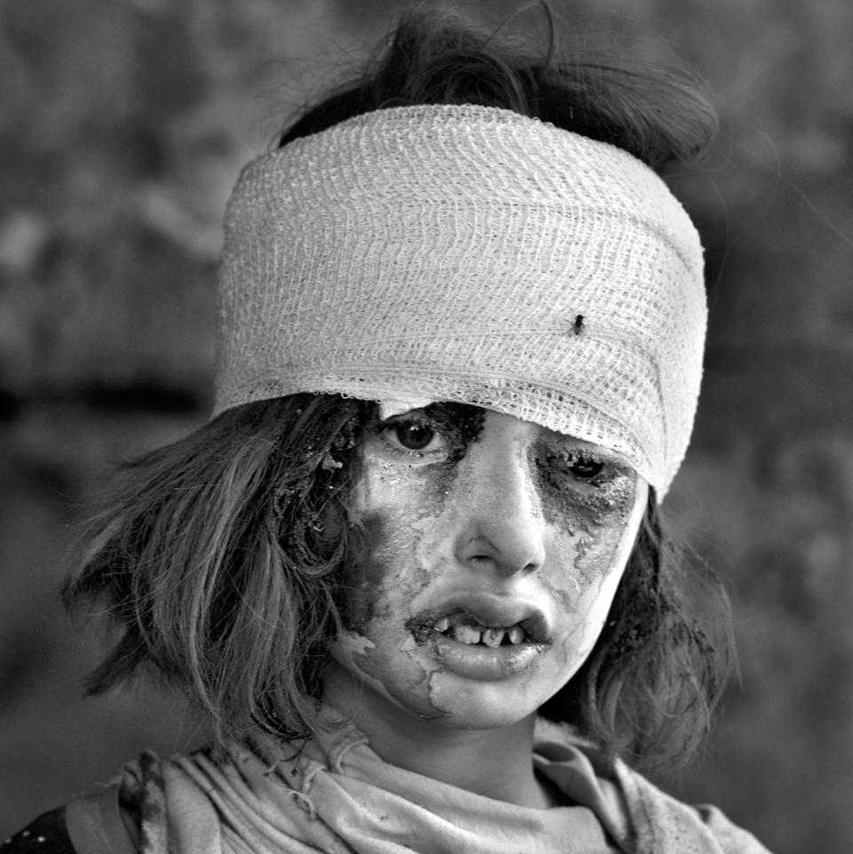  An injured girl arrives at a medical Trauma Stabilization Point near the Old City