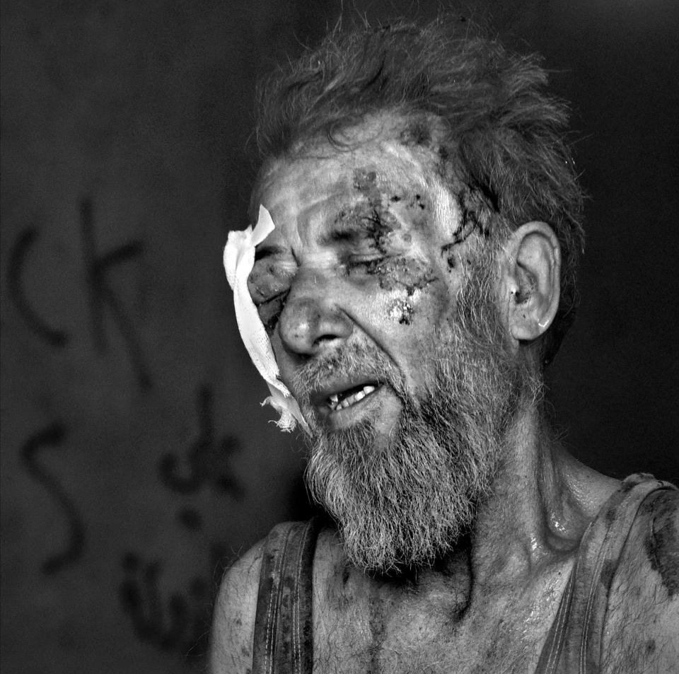  A man receives emergency medical care from Global Response Management at a Trauma Stabilization Point