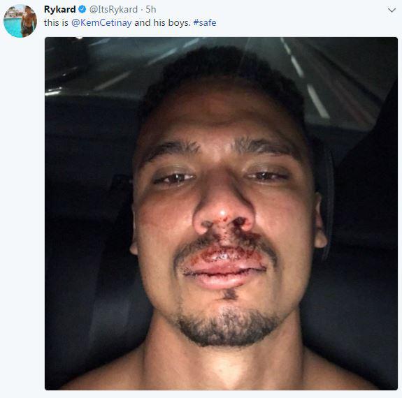 Rykard Jenkins was beaten up by some random men following the event