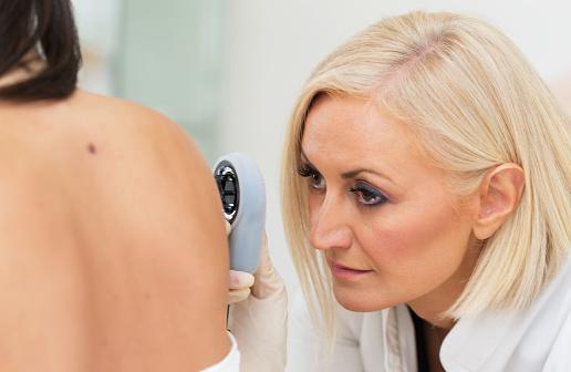 More than 70 per cent of melanomas start as new moles, research suggests