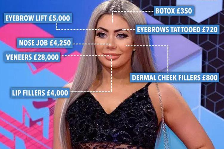  Chloe Ferry has already spent more than £43,000 on surgery