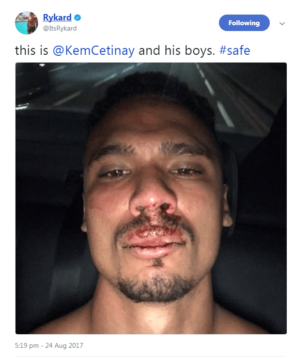  Rykard Jenkins tweeted this picture showing him with a bloodied face