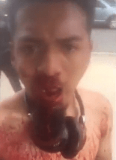  The unidentified man filmed himself covered in blood