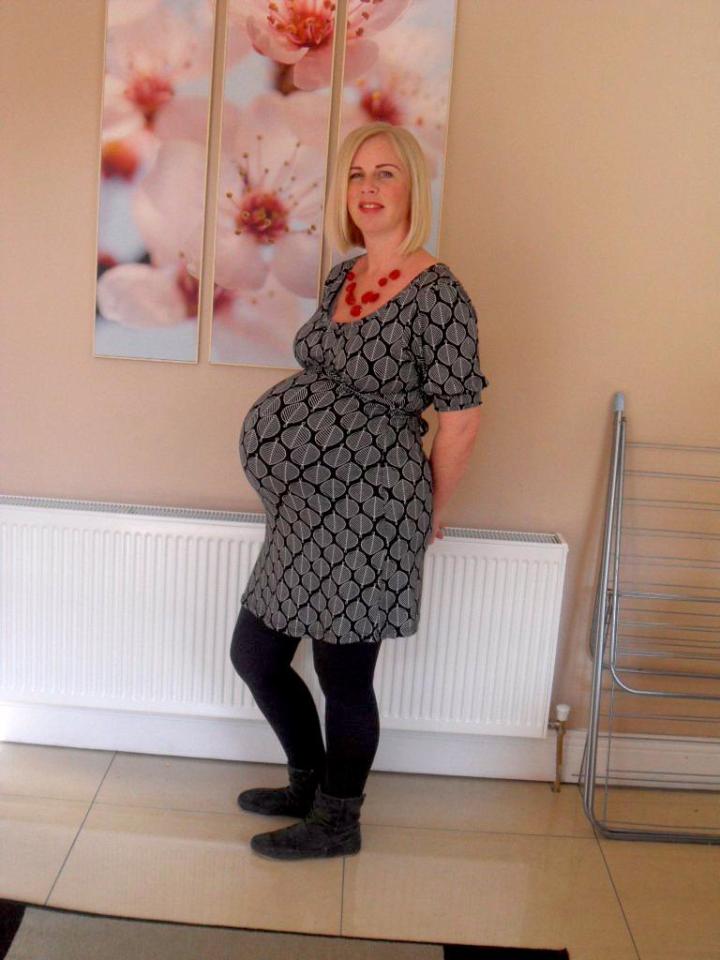  Aisling decided to get the procedure following three pregnancies, but there were complications after the surgery