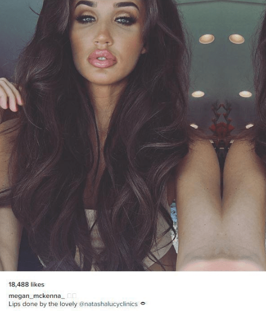  These days Megan is very pouty thanks to lip fillers