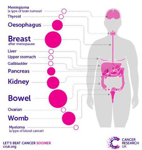  Being overweight is linked to at least 11 different types of cancer