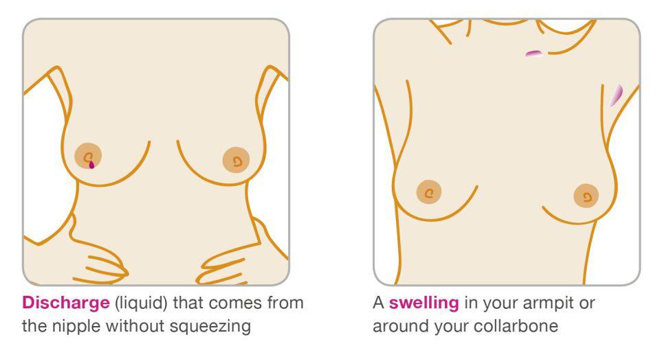  Discharge from your nipple or a swelling in your armpit could also indicate cancer