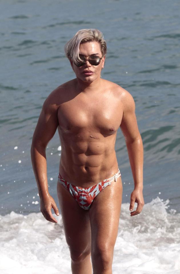  Human Ken Doll Rodrigo Alves is having six ribs removed