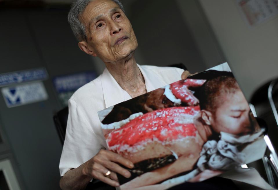  Sumiteru Taniguchi, a survivor of the 1945 bombing of Nagasaki, shows a photo of himself taken in 1945