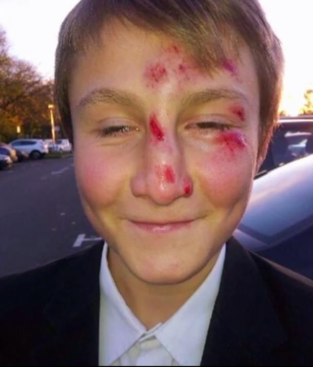  At just 11-years-old, David returned home with a bloodied face after bullies at school went for him