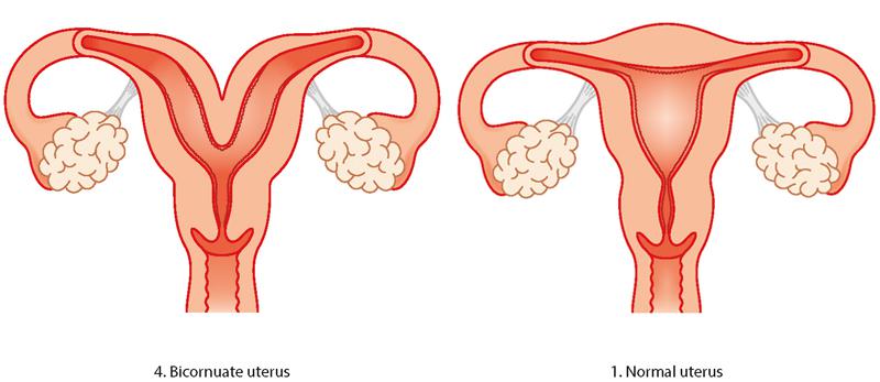 Rebecca was told she had a bicornuate, or heart-shaped, womb which contributed to her miscarriages [stock image]