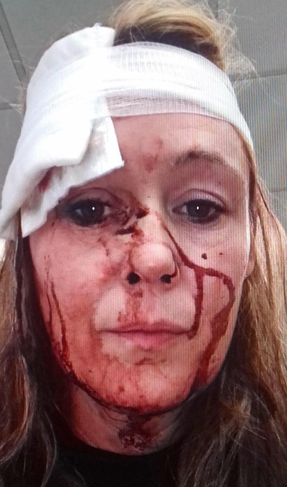  Sarah told how thug Jason Rhodes bit her and headbutted her during the attack