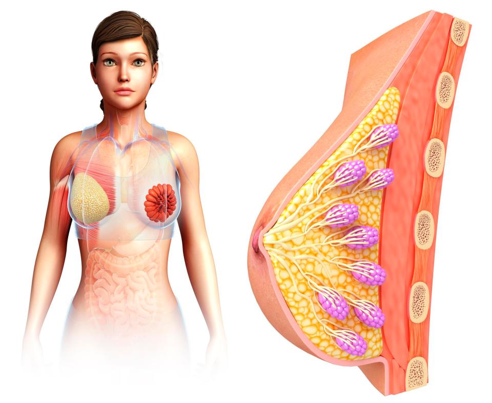  Your breasts are made up of fatty and glandular tissue and the bigger they are the quicker they will droop