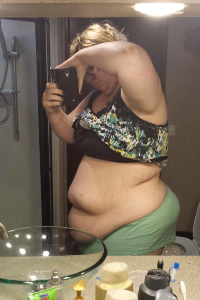  As her size 26 bulk began getting in the way of her every-day life, doctors recommended surgery