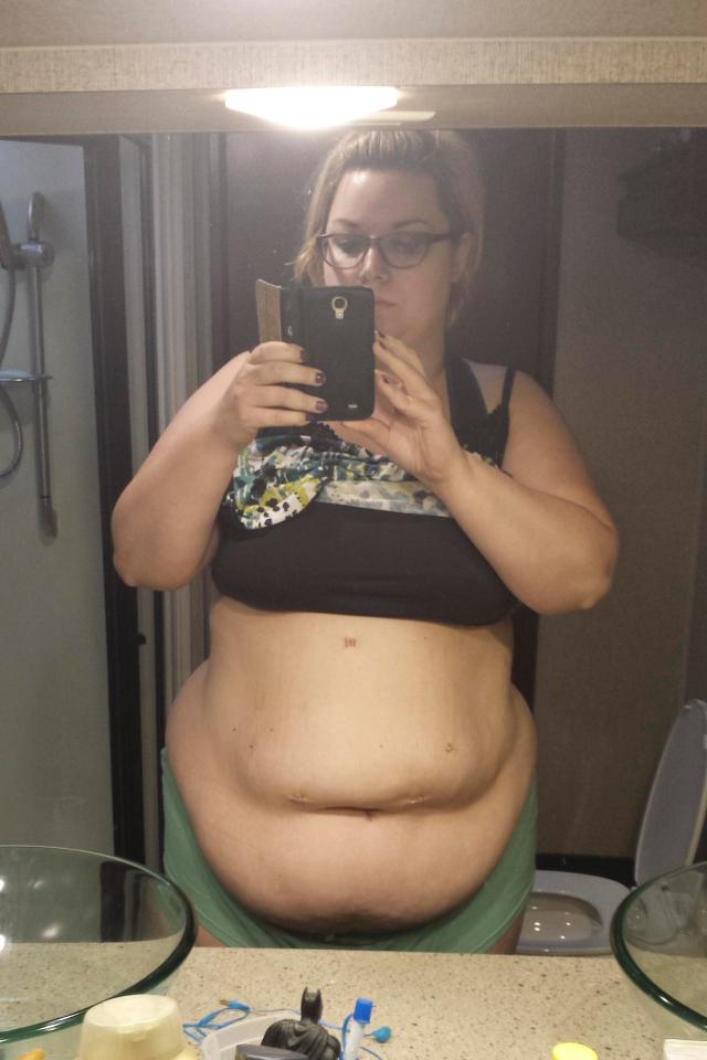  Before getting a gastric sleeve fitted, Jessica tipped the scales at 22st 3lbs