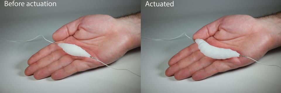  The muscle is shown in its resting state (left) and "actuated" state, which means it's contracted