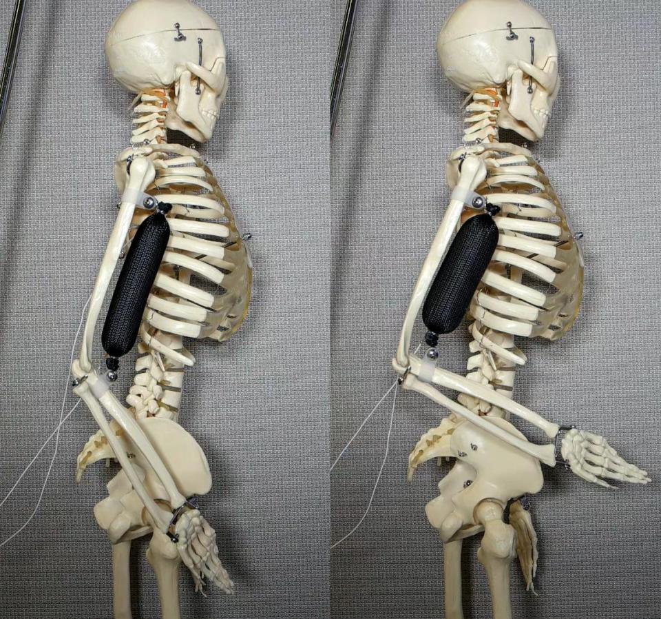  The artificial muscle in use. It's working as a bicep to lift a skeleton's arm to a 90 degree angle