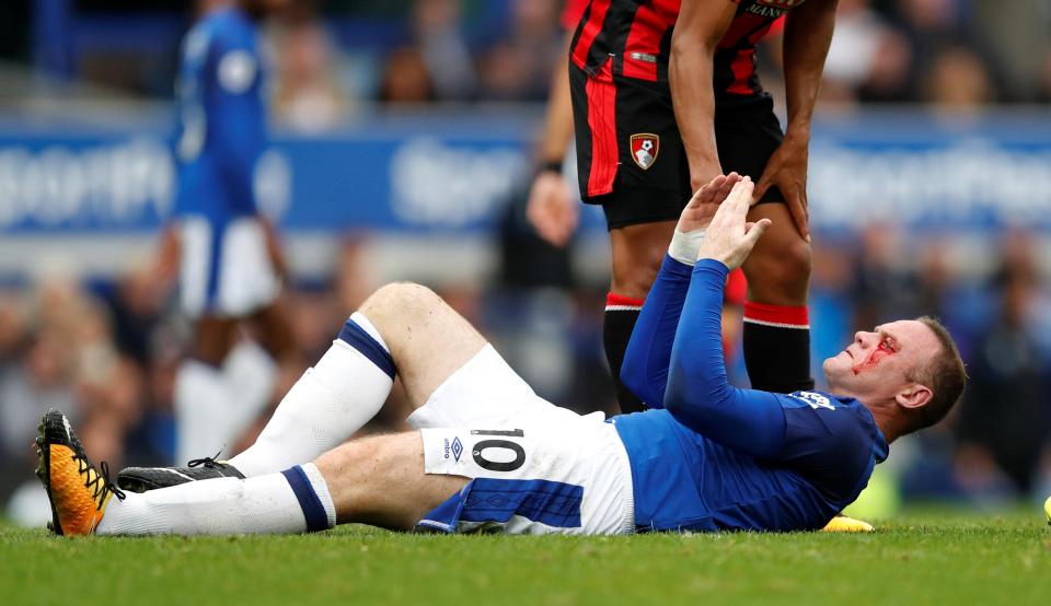  Everton star Wayne Rooney lies on the ground as he got whacked by an elbow to the face