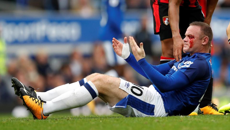  Wayne Rooney hit the deck bleeding heavily after being caught with an elbow