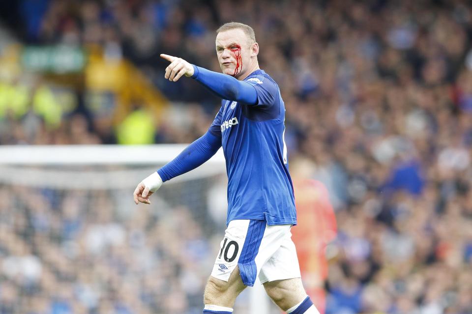  Wayne Rooney was left angered by the elbow he suffered in the first half