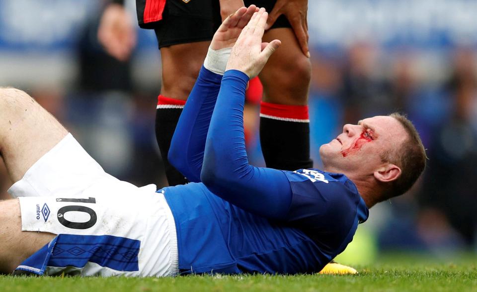  Wayne Rooney collapses on the ground after the collision