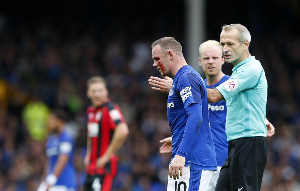  Wayne Rooney complained to ref Martin Atkinson after he appeared to be elbowed