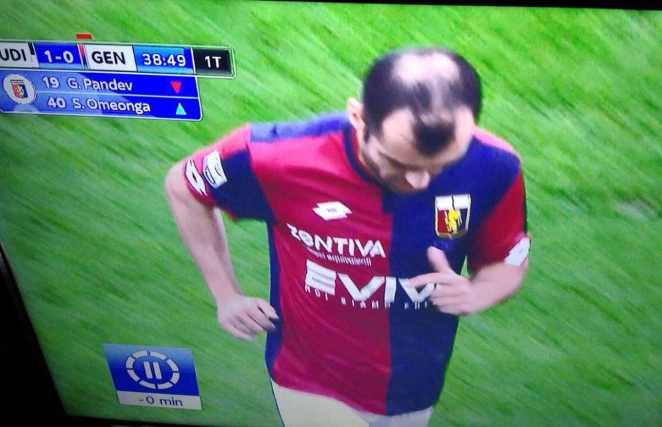  This picture of Goran Pandev's hairline sparked hilarity on social media