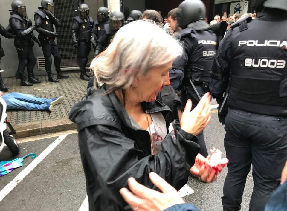  An injured woman reels after riot police shut down a polling station in Barcelona