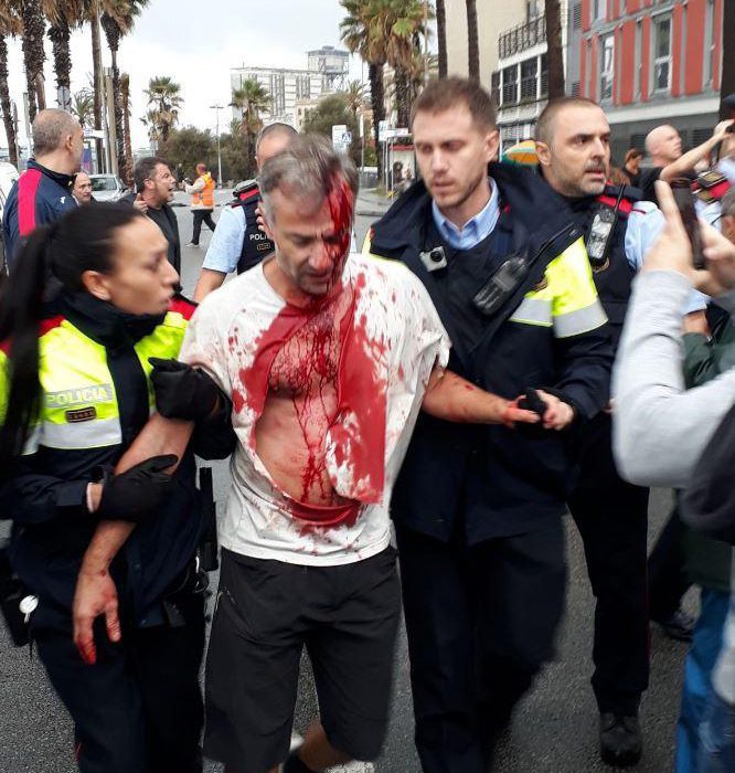  A middle-aged man is helped by emergency services after being left bloodied and beaten by police