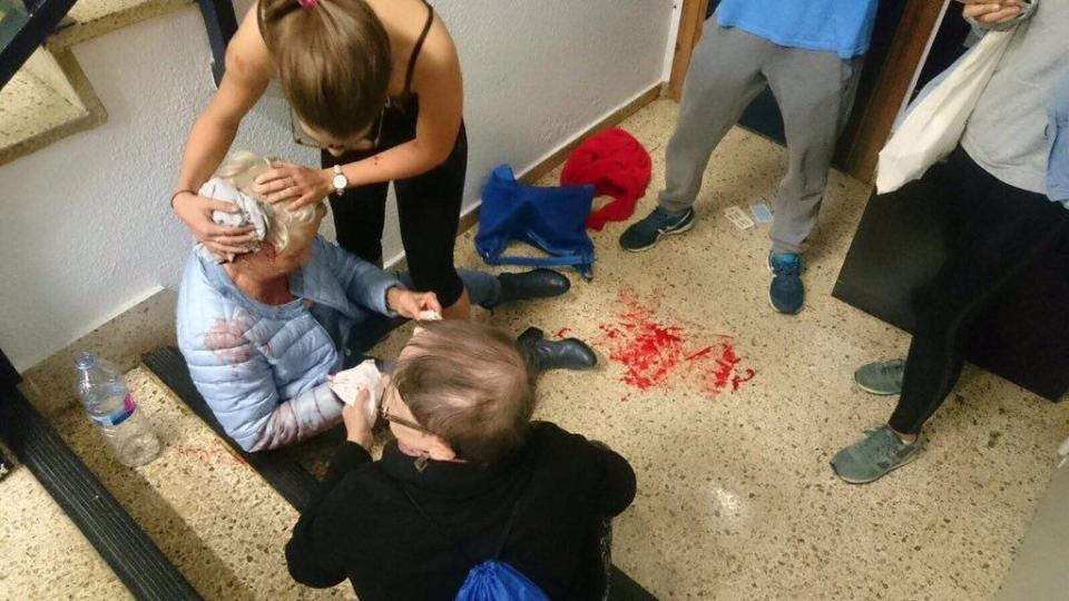  Her blood can be seen on the floor as a woman holds a cloth to her head