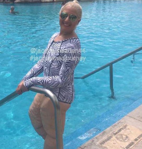  Jacqueline was determined to still enjoy her holiday and feel confident in her slimmer skin