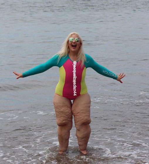  Jacqueline Adan was fat shamed when she wore a swimsuit on holiday for the first time since losing 25 stone