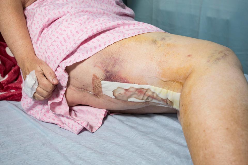  The painful injuries caused in Wednesday's attack