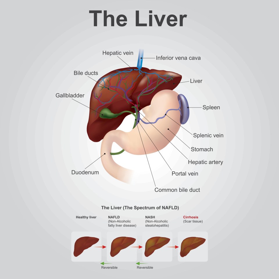 The liver can become damaged from excess alcohol consumption