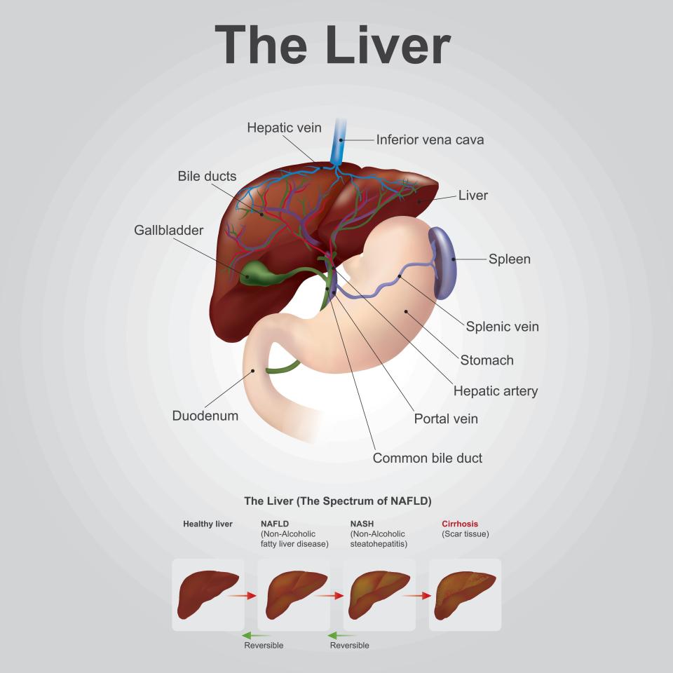  The liver can become damaged from excess alcohol consumption