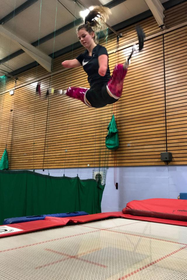  Sporty Izzy stunned doctors by winning a trampolining competition