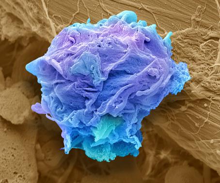  Scientists hope the treatment, which targets cells, will work for a variety of cancers