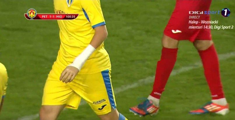 Cosmin Lambru played for Petrolul Ploiesti despite having plastic left hand